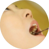 歯周病・口臭予防