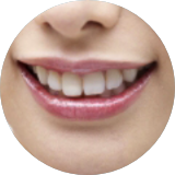 ホワイトニング